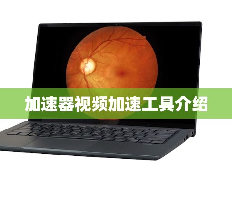 加速器视频加速工具介绍